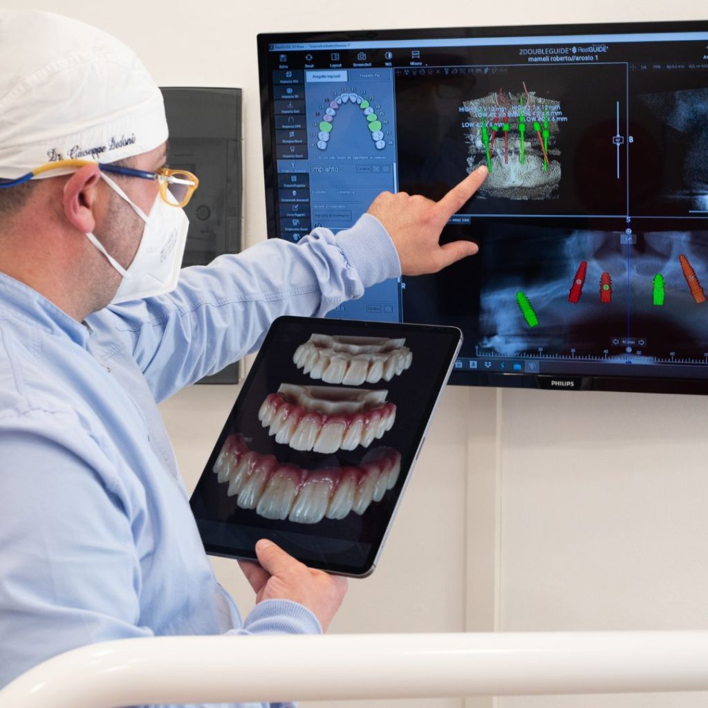 Implantologia 1 Impianto dentale a Isili