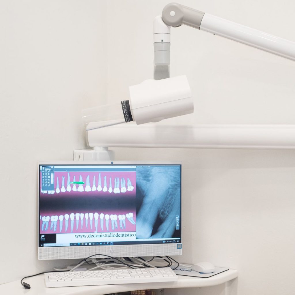 Endodonzia 1 Devitalizzazione dente a Isili