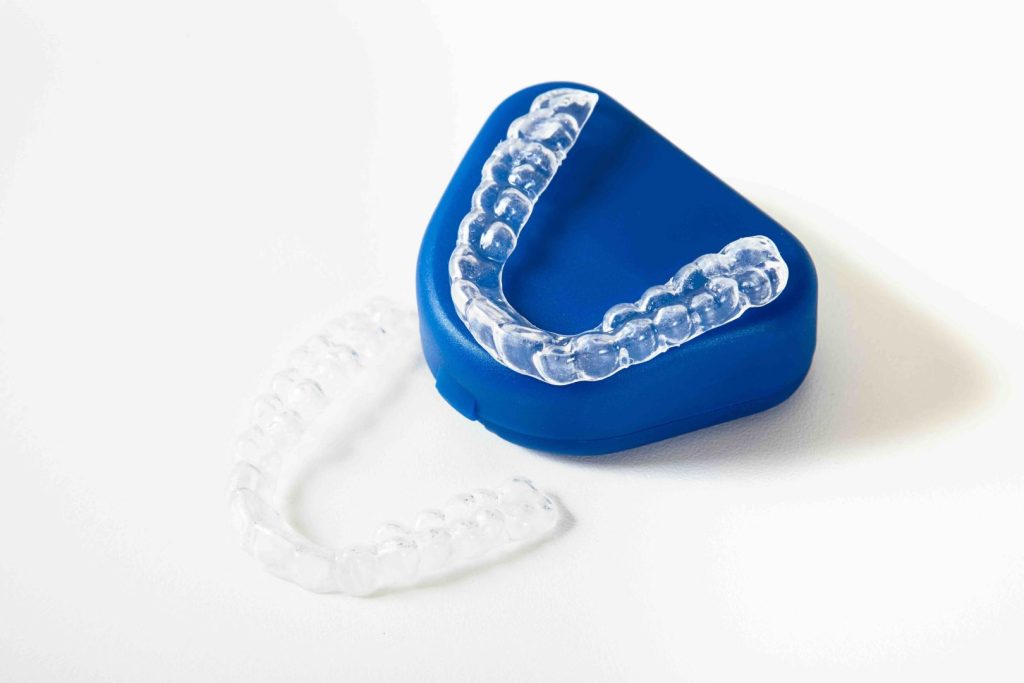 Come pulire apparecchio trasparente: guida completa per mantenerlo in perfette condizioni 1 Come pulire apparecchio trasparente